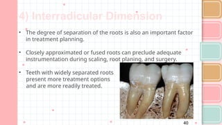Interradicular Root Comprehensive Overview of Furcation Involvement in Multirooted Teeth ...