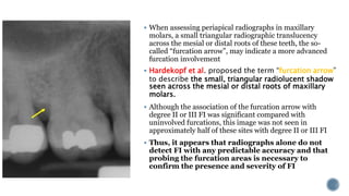 furcation involvmentt dental disease.pptx