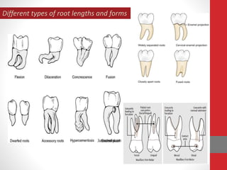 Different types of root lengths and forms
 