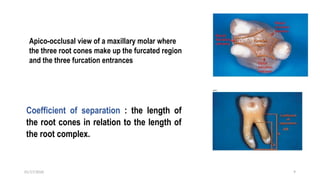 FURCATION INVOLVEMENT IN PERIODONTOLOGY | PPTX