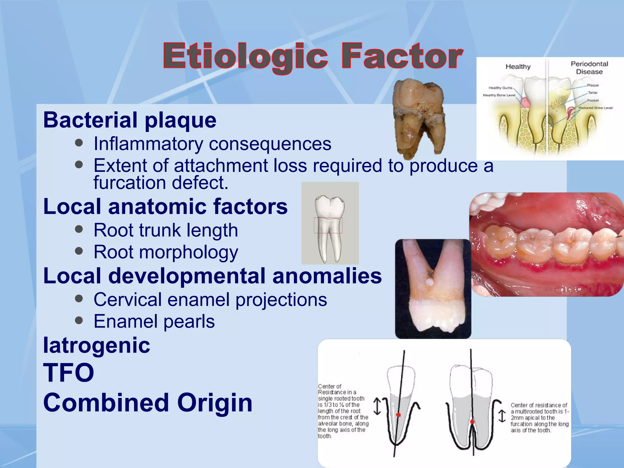 Bacterial plaque
 Inflammatory consequences
 Extent of attachment loss required to produce a
furcation defect.
Local anatomic factors
 Root trunk length
 Root morphology
Local developmental anomalies
 Cervical enamel projections
 Enamel pearls
Iatrogenic
TFO
Combined Origin
 