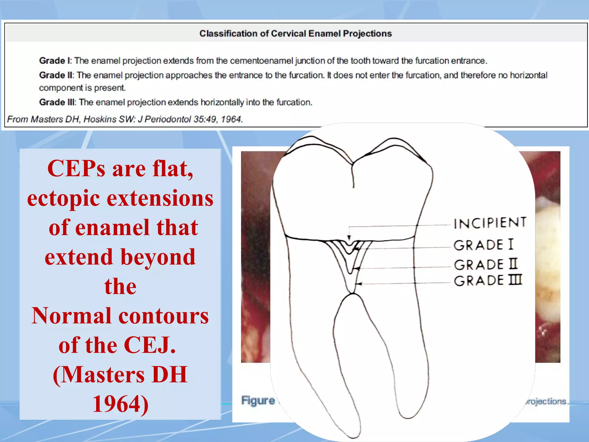CEPs are flat,
ectopic extensions
of enamel that
extend beyond
the
Normal contours
of the CEJ.
(Masters DH
1964)
 
