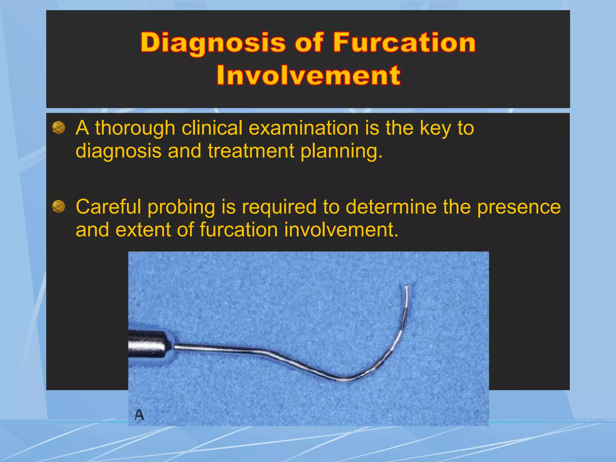 A thorough clinical examination is the key to
diagnosis and treatment planning.
Careful probing is required to determine the presence
and extent of furcation involvement.
 