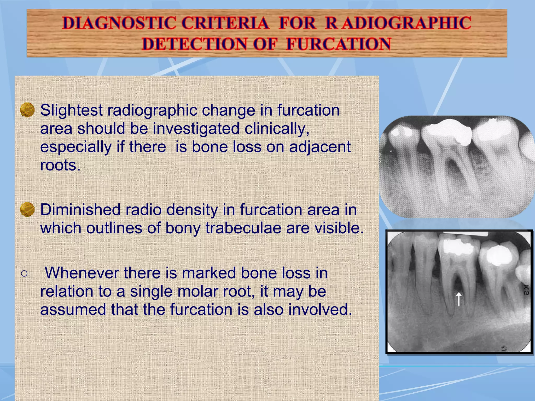 Slightest radiographic change in furcation
area should be investigated clinically,
especially if there is bone loss on adjacent
roots.
Diminished radio density in furcation area in
which outlines of bony trabeculae are visible.
o Whenever there is marked bone loss in
relation to a single molar root, it may be
assumed that the furcation is also involved.
 
