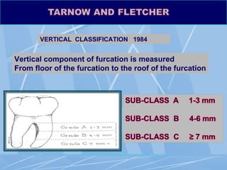 Furcation involvement (Dr. Himanshu Shekhar) | PPT