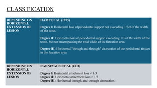 Hamp Classification Comprehensive Management of Furcation Involvement in Periodontal ...