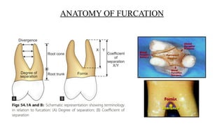 Comprehensive Management of Furcation Involvement in Periodontal ...