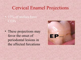 Cervical Enamel Projections
• 13% of molars have
CEPs
• These projections may
favor the onset of
periodontal lesions in
the affected furcations
 