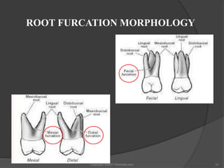 Furcation the problem and its management | PPTX