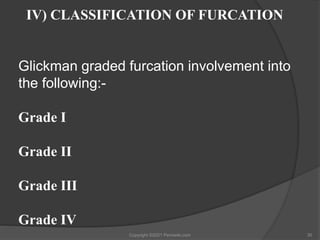 Hamp Classification Furcation the problem and its management | PPTX