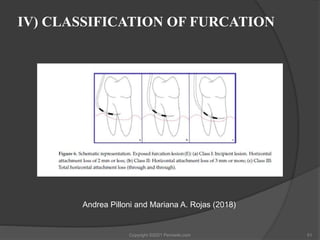 Furcation the problem and its management | PPTX