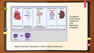 Congestión
renal venosa,
evitando la
LRA
Nefropatia
congestiva
Miguel Joannidis1, Sebastián J. Klein1y Marlies Ostermann
 
