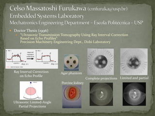 ? Doctor Thesis (1996)
? Ultrasonic Transmission Tomography Using Ray Interval Correction

Based on Echo Profiles
Precision Machinery Engineering Dept., Dohi Laboratory

Ray Interval Correction
on Echo Profile

Agar phantom
Complete projections Limited and partial
Porcine kidney

Ultrasonic Limited-Angle
Partial Projections

 