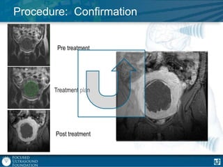 Procedure: Confirmation
Pre treatment

Treatment plan

Post treatment

 