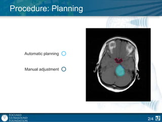 Procedure: Planning

Automatic planning

Manual adjustment

2/4

 