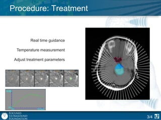Procedure: Treatment

Real time guidance
Temperature measurement
Adjust treatment parameters

3/4

 