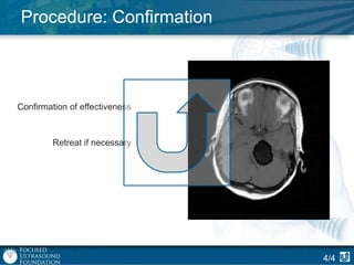 Procedure: Confirmation

Confirmation of effectiveness

Retreat if necessary

4/4

 