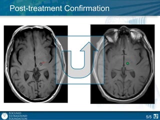 Post-treatment Confirmation

5/5

 