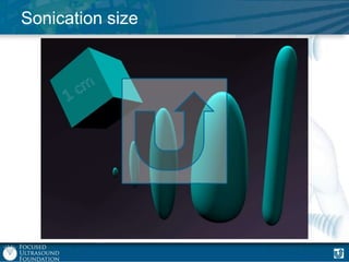 Sonication size

 