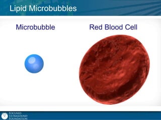 Lipid Microbubbles

 