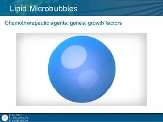 Lipid Microbubbles
Chemotherapeutic agents; genes; growth factors

 
