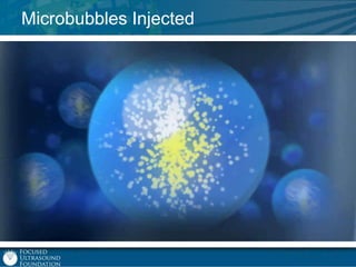Microbubbles Injected

 