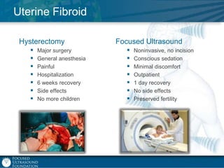 Uterine Fibroid
Hysterectomy








Major surgery
General anesthesia
Painful
Hospitalization
6 weeks recovery
Side effects
No more children

Focused Ultrasound








Noninvasive, no incision
Conscious sedation
Minimal discomfort
Outpatient
1 day recovery
No side effects
Preserved fertility

 