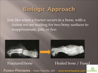 Fusion Principles by Pablo Pazmino MD | PPT
