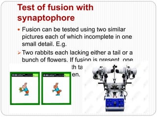 Test of fusion with
synaptophore
 Fusion can be tested using two similar
pictures each of which incomplete in one
small detail. E.g.
Two rabbits each lacking either a tail or a
bunch of flowers. If fusion is present, one
rabbit complete with tail and holding a bunch
of flower will be seen.
 