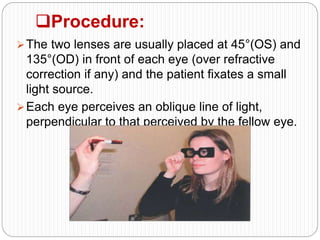 Procedure:
The two lenses are usually placed at 45°(OS) and
135°(OD) in front of each eye (over refractive
correction if any) and the patient fixates a small
light source.
Each eye perceives an oblique line of light,
perpendicular to that perceived by the fellow eye.
 