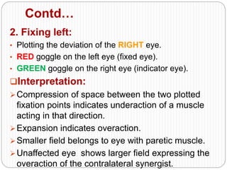Contd…
2. Fixing left:
• Plotting the deviation of the RIGHT eye.
• RED goggle on the left eye (fixed eye).
• GREEN goggle on the right eye (indicator eye).
Interpretation:
Compression of space between the two plotted
fixation points indicates underaction of a muscle
acting in that direction.
Expansion indicates overaction.
Smaller field belongs to eye with paretic muscle.
Unaffected eye shows larger field expressing the
overaction of the contralateral synergist.
 