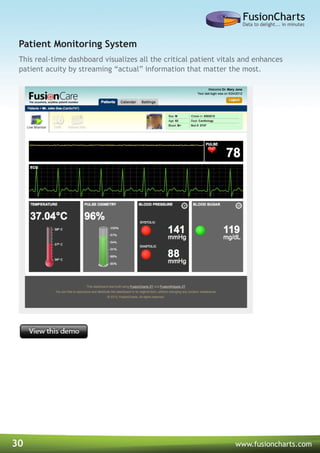 30 www.fusioncharts.com
This real-time dashboard visualizes all the critical patient vitals and enhances
patient acuity by streaming “actual” information that matter the most.
Patient Monitoring System
 