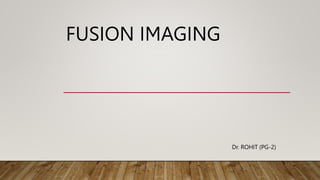 FUSION IMAGING
Dr. ROHIT (PG-2)
 