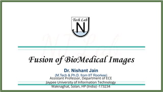 Dr. Nishant Jain
(M.Tech & Ph.D. from IIT Roorkee)
Fusion of BioMedical Images
Assistant Professor, Department of ECE
Jaypee University of Information Technology
Waknaghat, Solan, HP (India) -173234
 
