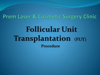 Follicular Unit
Transplantation (FUT)
Procedure
 