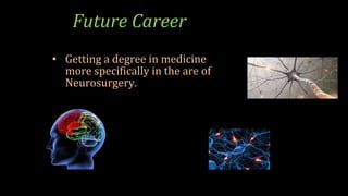 • Getting a degree in medicine
more specifically in the are of
Neurosurgery.
Future Career
 