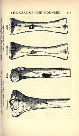 THE CARE OF THE WOUNDED   153




w
 