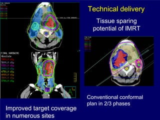 Technical delivery
                              Tissue sparing
                             potential of IMRT




                           Conventional conformal
                           plan in 2/3 phases
Improved target coverage
in numerous sites
 
