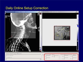 Daily Online Setup Correction
 