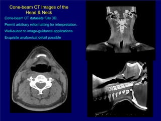 Cone-beam CT Images of the
          Head & Neck
Cone-beam CT datasets fully 3D.
Permit arbitrary reformatting for interpretation.
Well-suited to image-guidance applications.
Exquisite anatomical detail possible
 