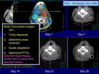 NCI – All Ireland - Nov 2006




Daily Cone beam images
    can:
1. TrackCT sim
Planning response             Day 1               Day 7
2. Determine dose
   received
3. Guide adaptation
4. Determine PTVs
Data from David Hwang
Similar data on spinal cord
Mehrdad Vakilha


      Day 14                  Day 21                Day 35
 