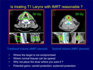 Is treating T1 Larynx with IMRT reasonable ?
                       50 Gy                                  50 Gy




Traditional Volume (IMRT planned)        Optimal Volume (IMRT planned)

 •    Where the target is not compromised
 •    Where normal tissues can be spared
 •    Why not place the dose where you want it ?
 •    Potential gains: carotid protection; arytenoid protection
 