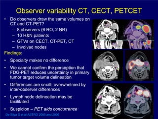 Observer variability CT, CECT, PETCET
•  Do observers draw the same volumes on
   CT and CT-PET?
    – 8 observers (6 RO, 2 NR)
    – 10 H&N patients
    – GTVs on CECT, CT-PET, CT               CECT   PETCT

    – Involved nodes
Findings:
•   Specialty makes no difference
•   We cannot confirm the perception that
    FDG-PET reduces uncertainty in primary
    tumor target volume delineation
•   Differences are small, overwhelmed by
    inter-observer differences
•   Lymph node delineation may be
    facilitated
•   Suspicion – PET aids concurrence
De Silva S et al ASTRO 2005 and 2006
 