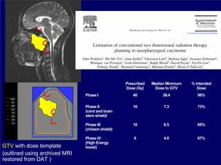 Prescribed   Median Minimum   % Intended
                                                 Dose (Gy)     Dose to GTV        Dose
                               Phase I              40             38.4           96%

                               Phase II             10             7.3            73%
                               (cord and brain
                               stem shield)

                               Phase III            10             6.5            65%
                               (chiasm shield)

                               Phase IV              6             4.0            67%
                               (High Energy
GTV with dose template         boost)
(outlined using archived MRI
restored from DAT )
 