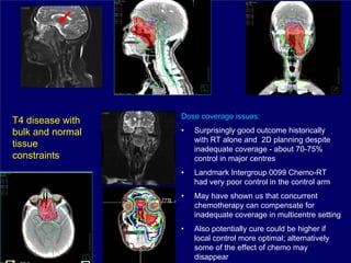 Dose coverage issues:
T4 disease with
bulk and normal   •   Surprisingly good outcome historically
                      with RT alone and 2D planning despite
tissue                inadequate coverage - about 70-75%
constraints           control in major centres
                  •   Landmark Intergroup 0099 Chemo-RT
                      had very poor control in the control arm
                  •   May have shown us that concurrent
                      chemotherapy can compensate for
                      inadequate coverage in multicentre setting
                  •   Also potentially cure could be higher if
                      local control more optimal; alternatively
                      some of the effect of chemo may
                      disappear
 
