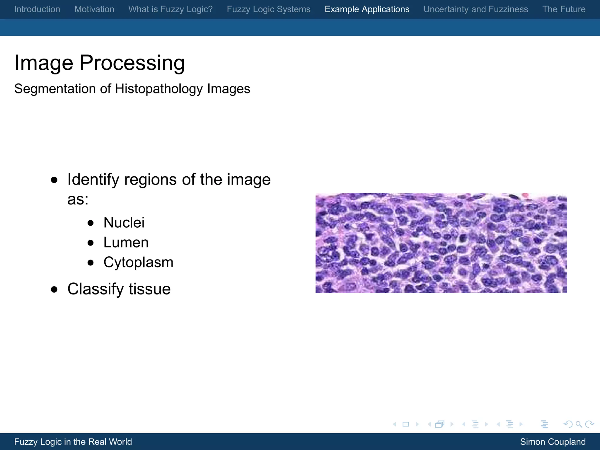 Introduction   Motivation   What is Fuzzy Logic?   Fuzzy Logic Systems   Example Applications   Uncertainty and Fuzziness   The Future




Image Processing
Segmentation of Histopathology Images




         • Identify regions of the image
           as:
                  • Nuclei
                  • Lumen
                  • Cytoplasm
         • Classify tissue




Fuzzy Logic in the Real World                                                                                          Simon Coupland
 