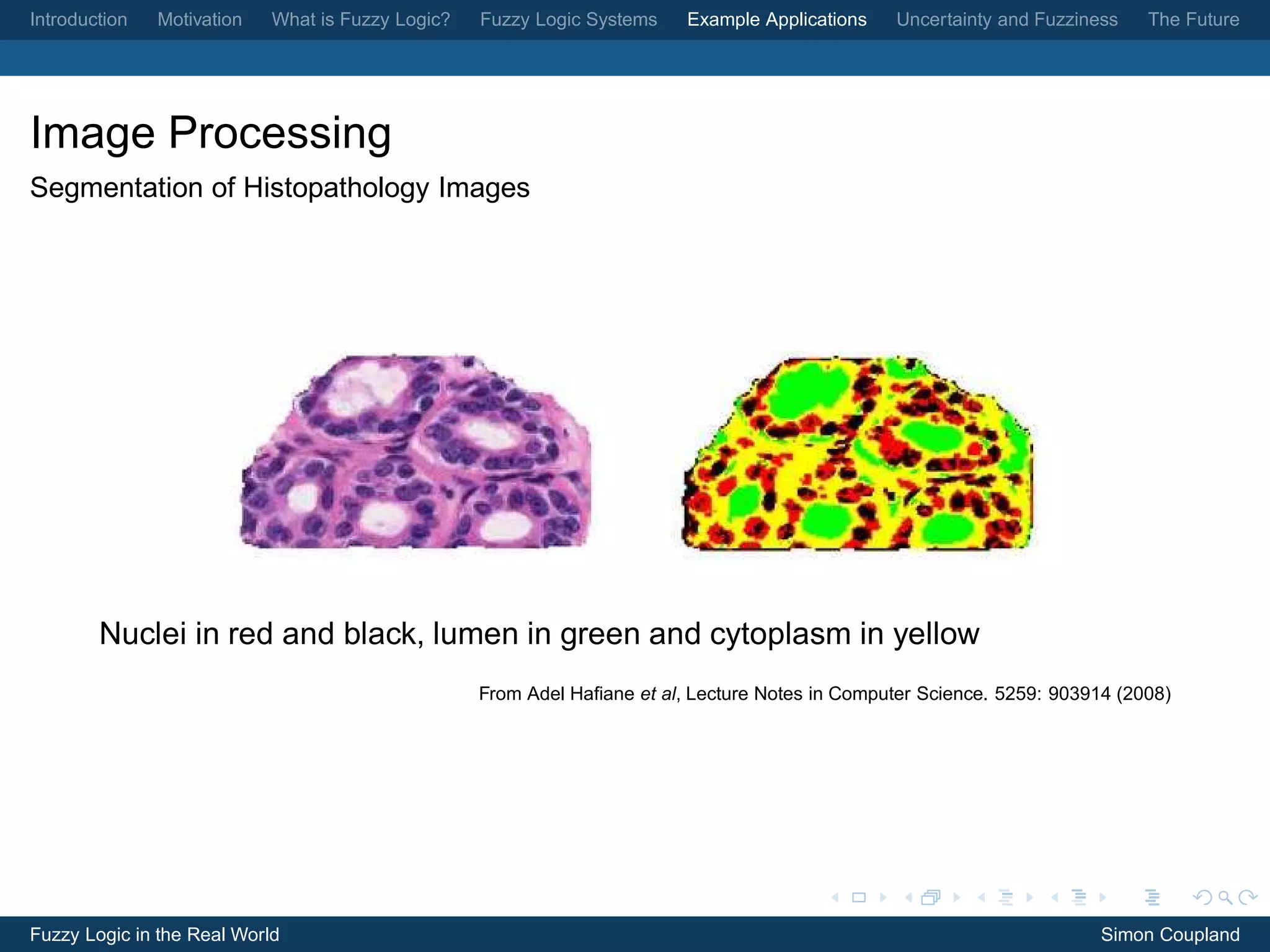 Introduction   Motivation   What is Fuzzy Logic?   Fuzzy Logic Systems    Example Applications    Uncertainty and Fuzziness   The Future




Image Processing
Segmentation of Histopathology Images




        Nuclei in red and black, lumen in green and cytoplasm in yellow
                                                   From Adel Haﬁane et al, Lecture Notes in Computer Science. 5259: 903914 (2008)




Fuzzy Logic in the Real World                                                                                            Simon Coupland
 
