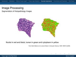 Introduction   Motivation   What is Fuzzy Logic?   Fuzzy Logic Systems    Example Applications    Uncertainty and Fuzziness   The Future




Image Processing
Segmentation of Histopathology Images




        Nuclei in red and black, lumen in green and cytoplasm in yellow
                                                   From Adel Haﬁane et al, Lecture Notes in Computer Science. 5259: 903914 (2008)




Fuzzy Logic in the Real World                                                                                            Simon Coupland
 