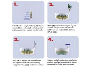 Cutaneous Tuberculosis