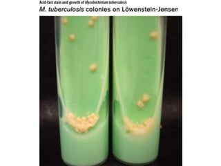 Cutaneous Tuberculosis